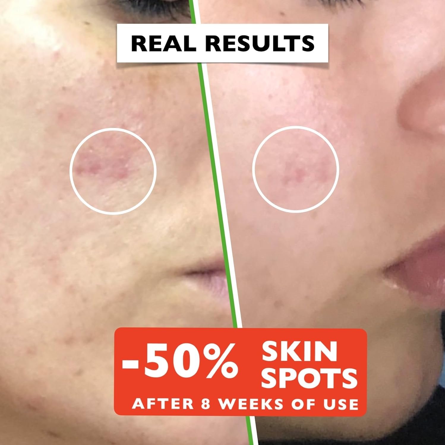 Big 2.11oz. Organic Vitamin C Serum for Face. Anti-Dark Spots, Wrinkles Skin Repair Serum with Hyaluronic Acid, Vitamin C & Niacinamide. All-in-One Brightening, Anti Aging Facial & Eye Area Skincare - Image 4
